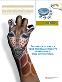 campagna per Ethicon Endo Surgery, Inc - Cincinnati Ohayo U.S.A. - Giraffa